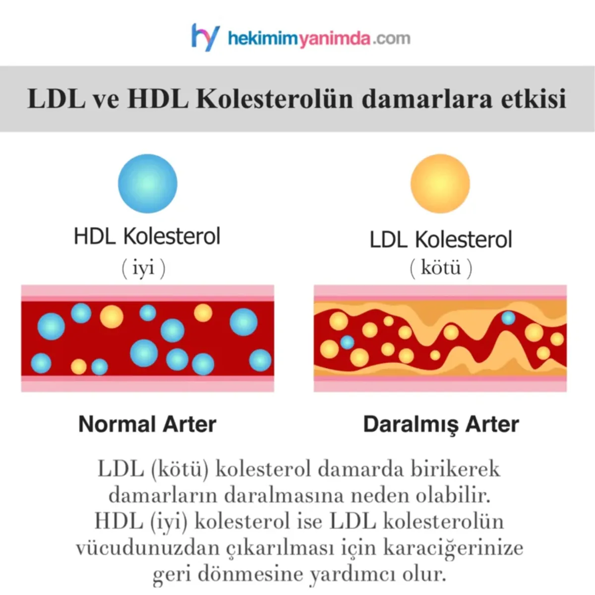 Damar Plaklarını Temizleyen Besinler: LDL Kolesterolle Mücadele Damar Plaklarını Temizleyen Besinler: LDL Kolesterolle Mücadele
